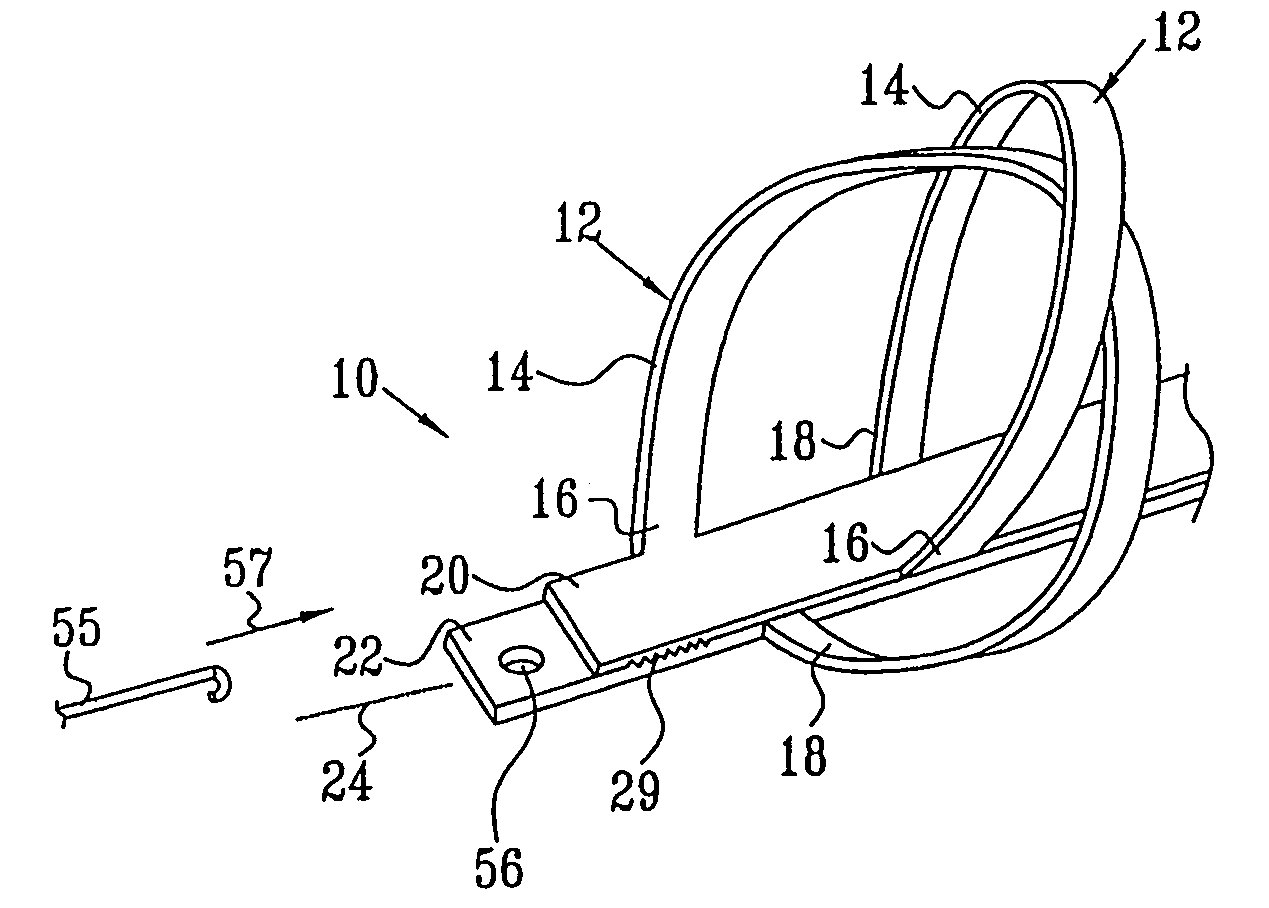 Selectively expandable and releasable stent