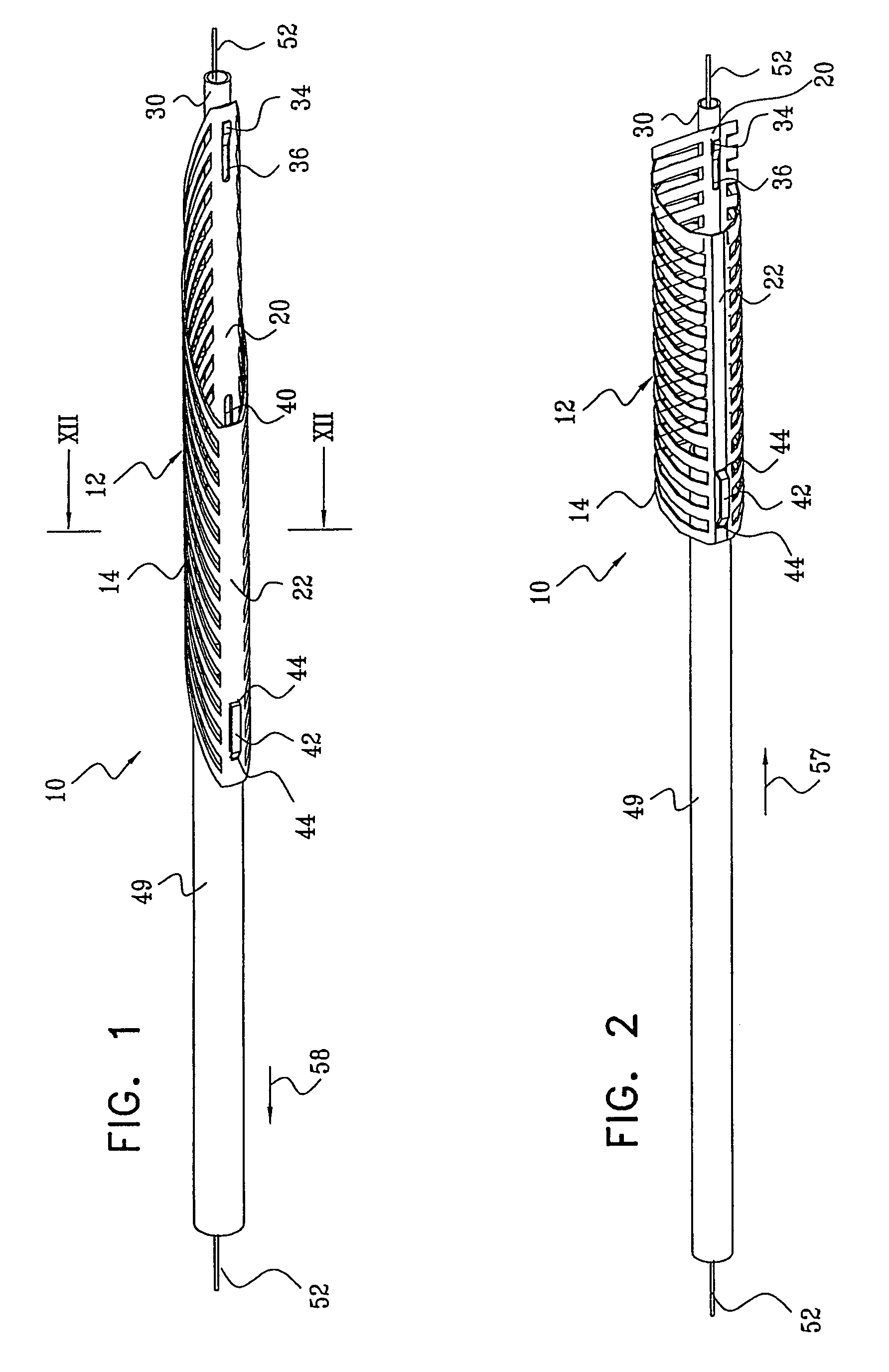 Selectively expandable and releasable stent