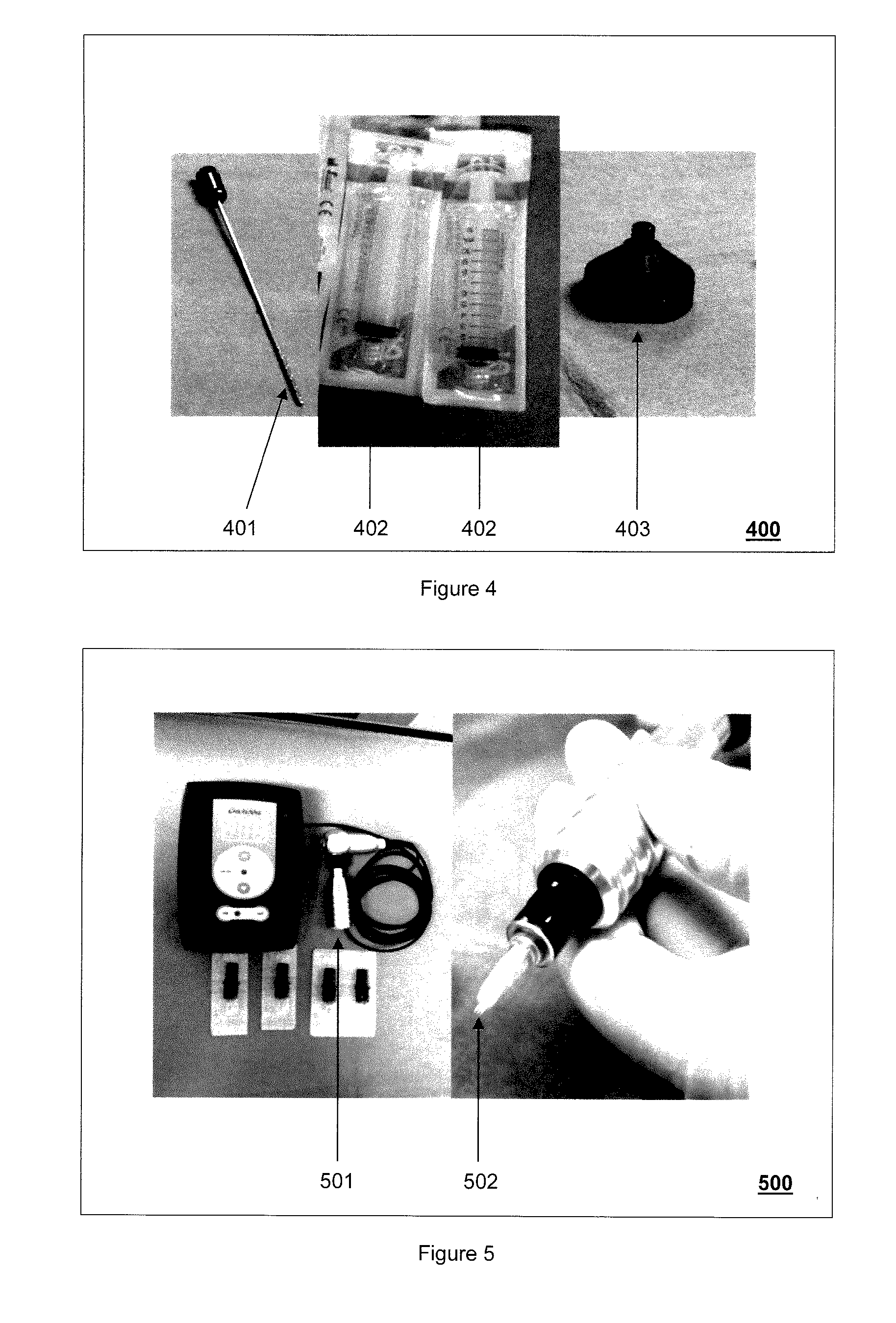 Surgical methods/devices for tissue injury removal by tattooing of autologous stem cells