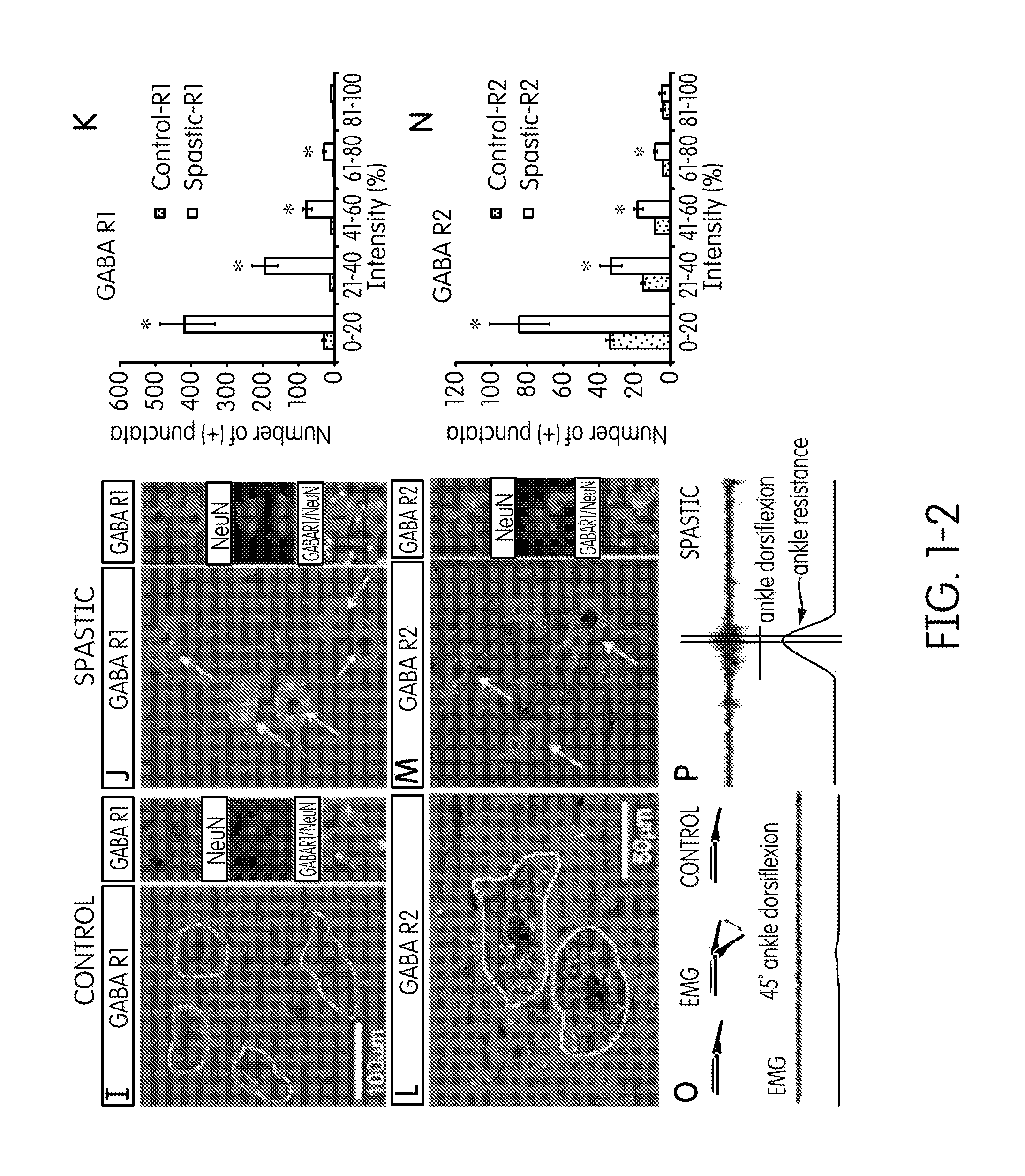 Method and composition for treating spasticity