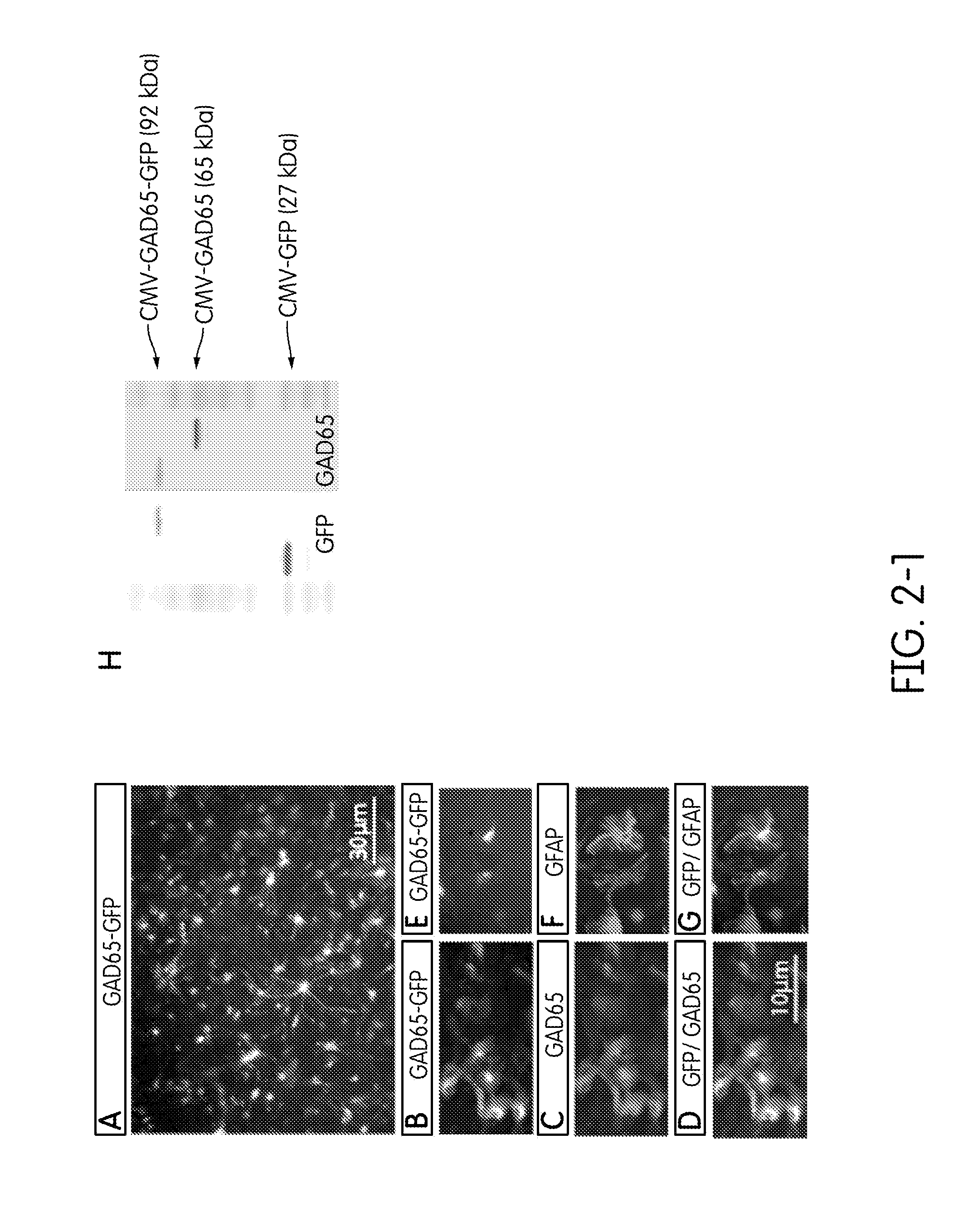 Method and composition for treating spasticity