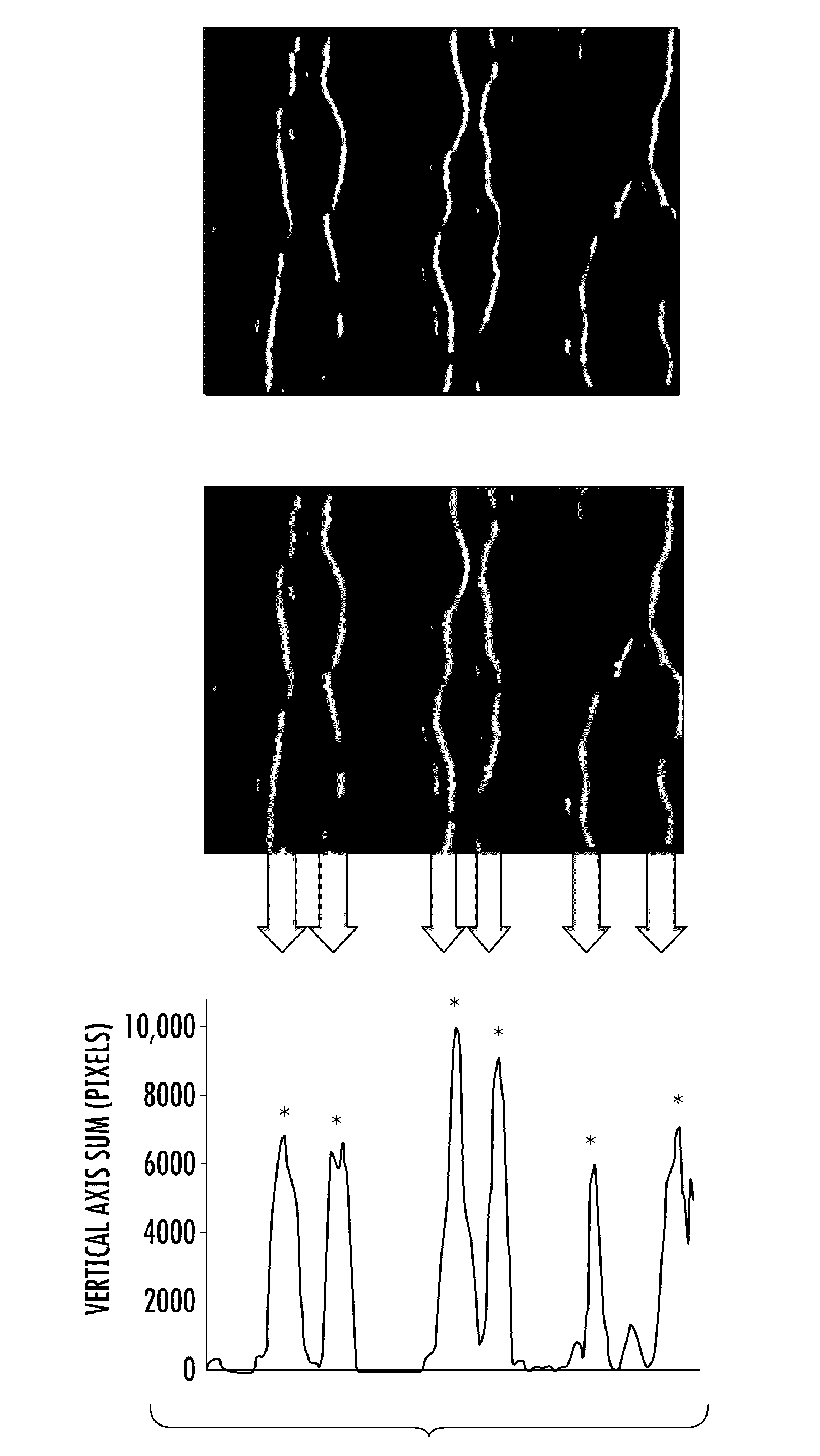 Automated methods to count corneal subbasal nerves