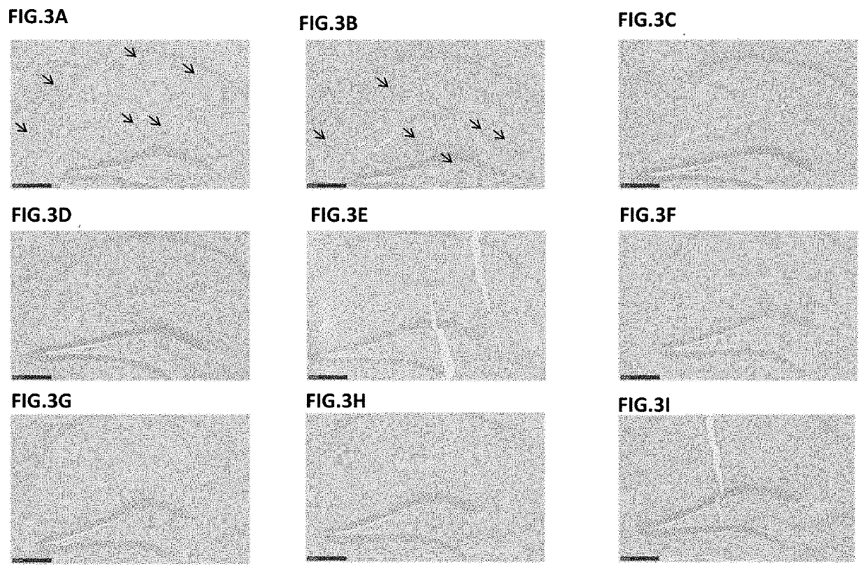 Antibodies to Pyroglutamate Amyloid-B and Uses Thereof