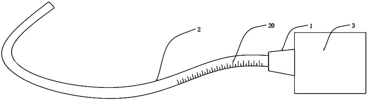 A visual gastric tube implantation system