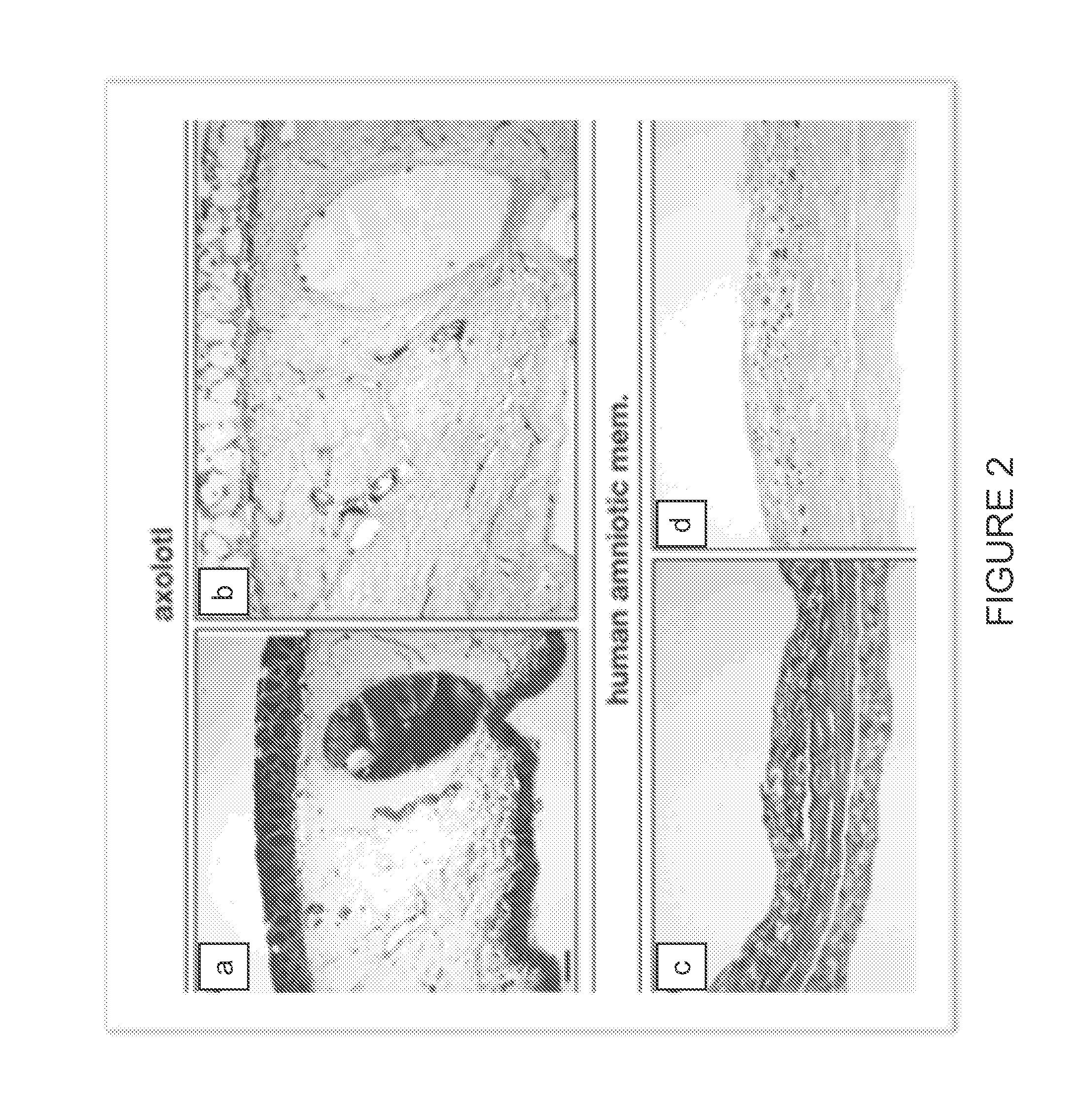 Decellularized biomaterial from non-mammalian tissue