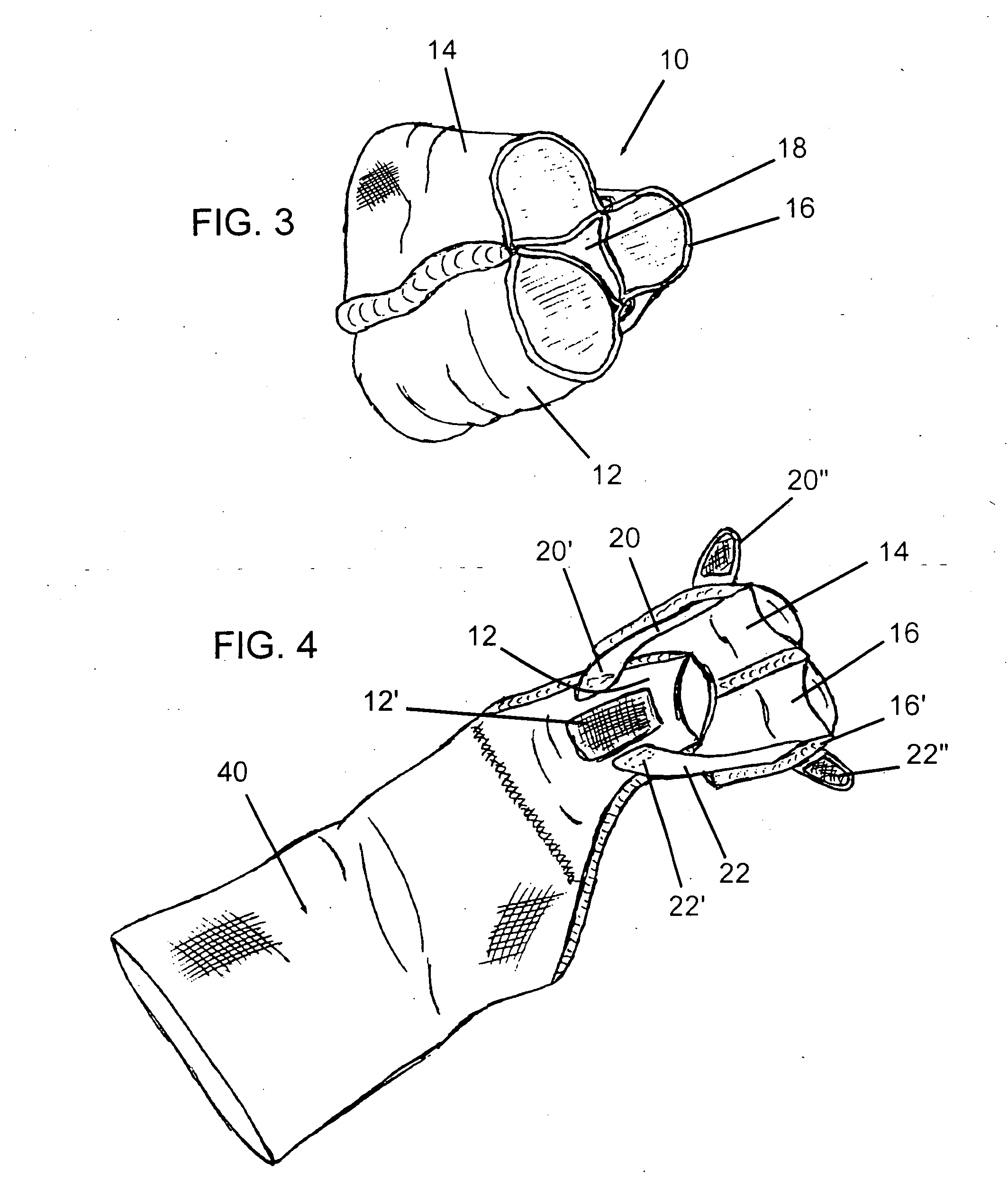 Digit-supporting therapeutic device for the hand