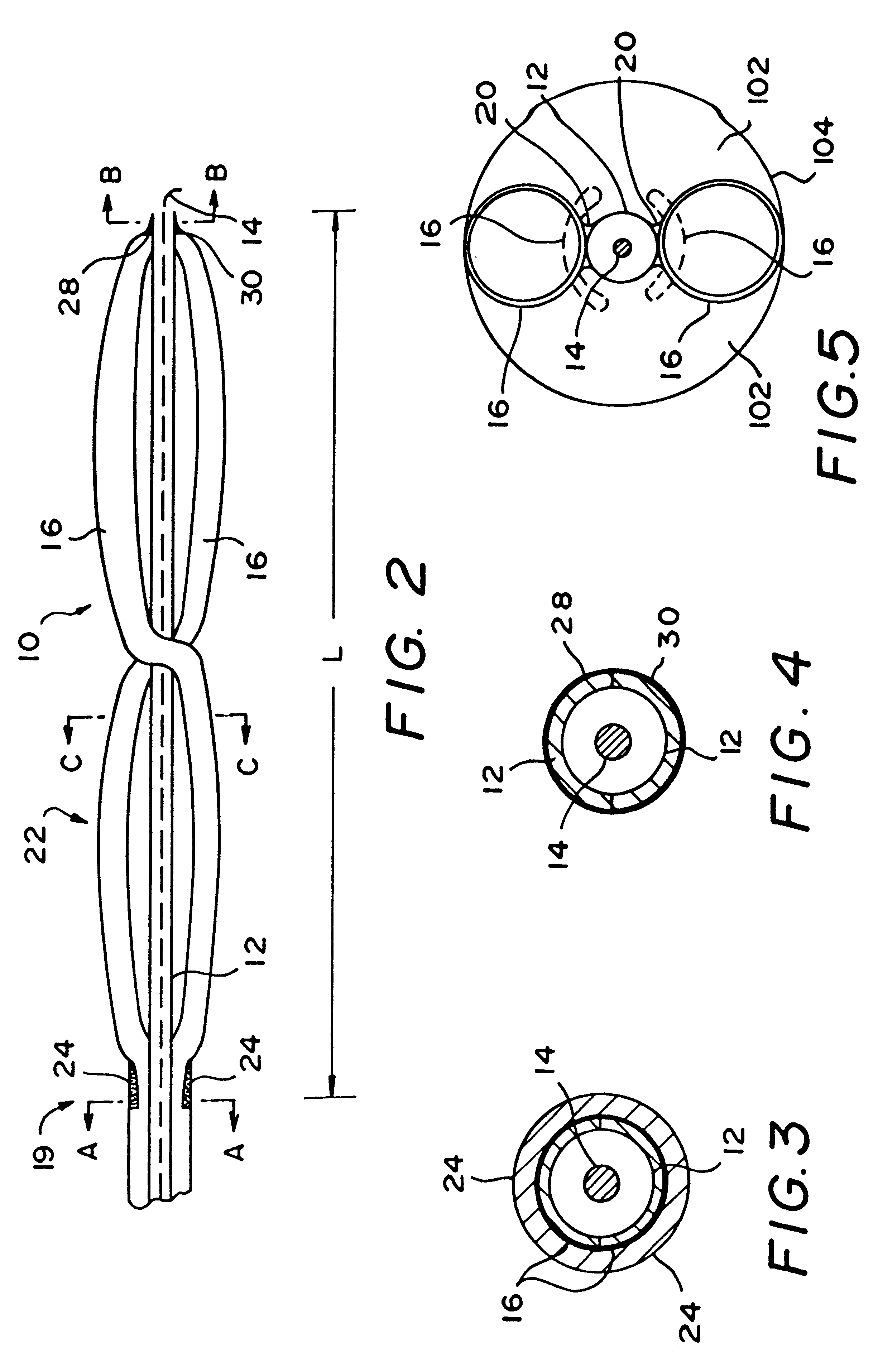 Helical spiral balloon catheter