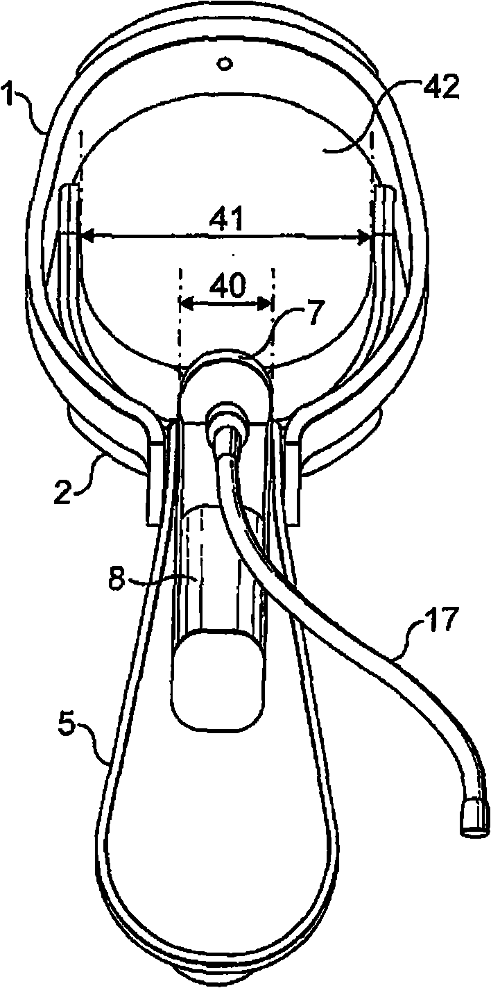 Vaginal speculum arrangement