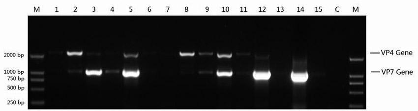 Human rotavirus strain and separation, culture and identification method thereof