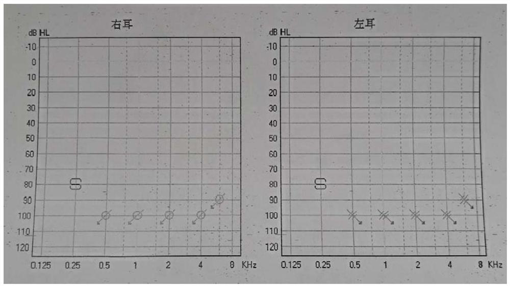 KCNQ1 gene mutant and use thereof