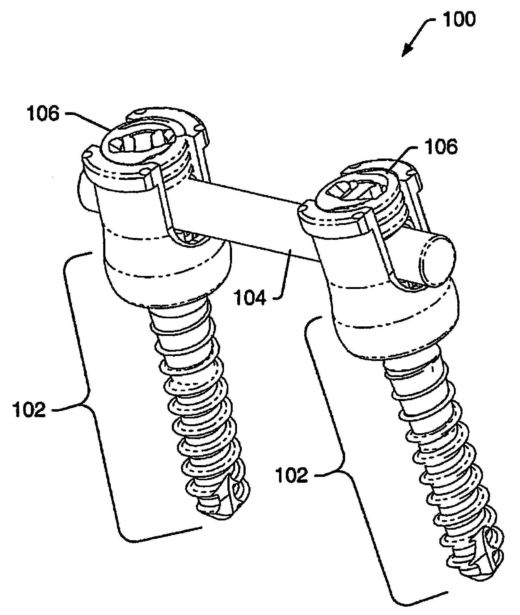 Dynamic stabilization system