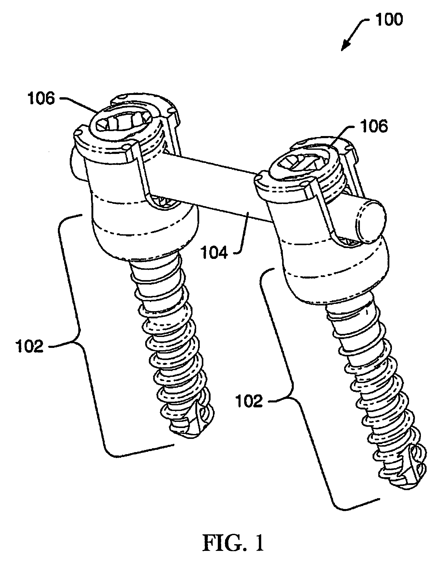 Dynamic stabilization system