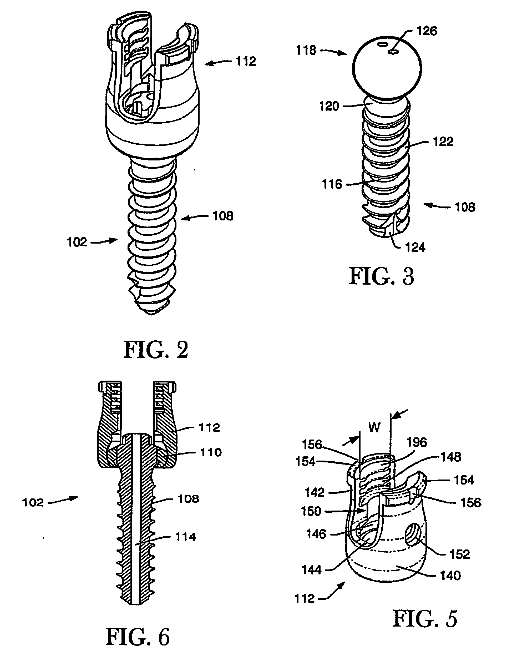 Dynamic stabilization system