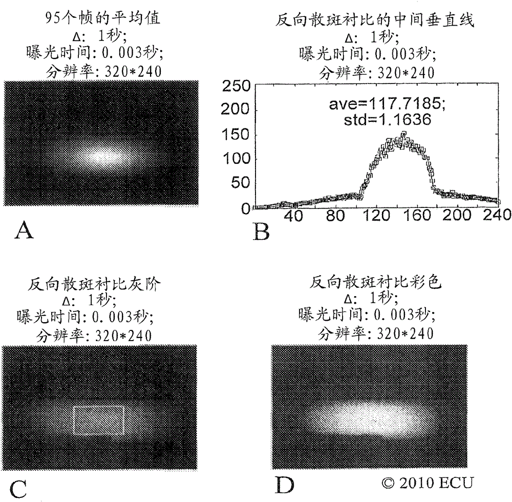 Methods, systems and computer program products for non-invasive determination of blood flow distribution using speckle imaging techniques and hemodynamic modeling