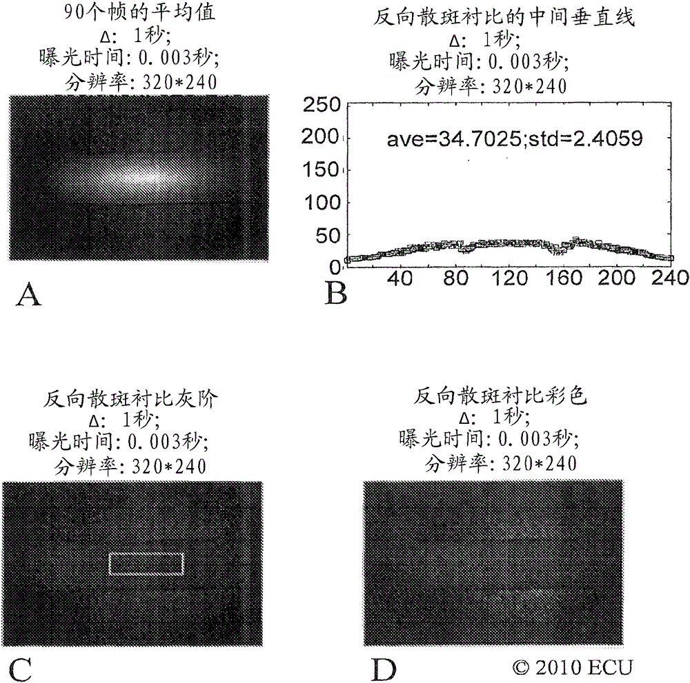 Methods, systems and computer program products for non-invasive determination of blood flow distribution using speckle imaging techniques and hemodynamic modeling