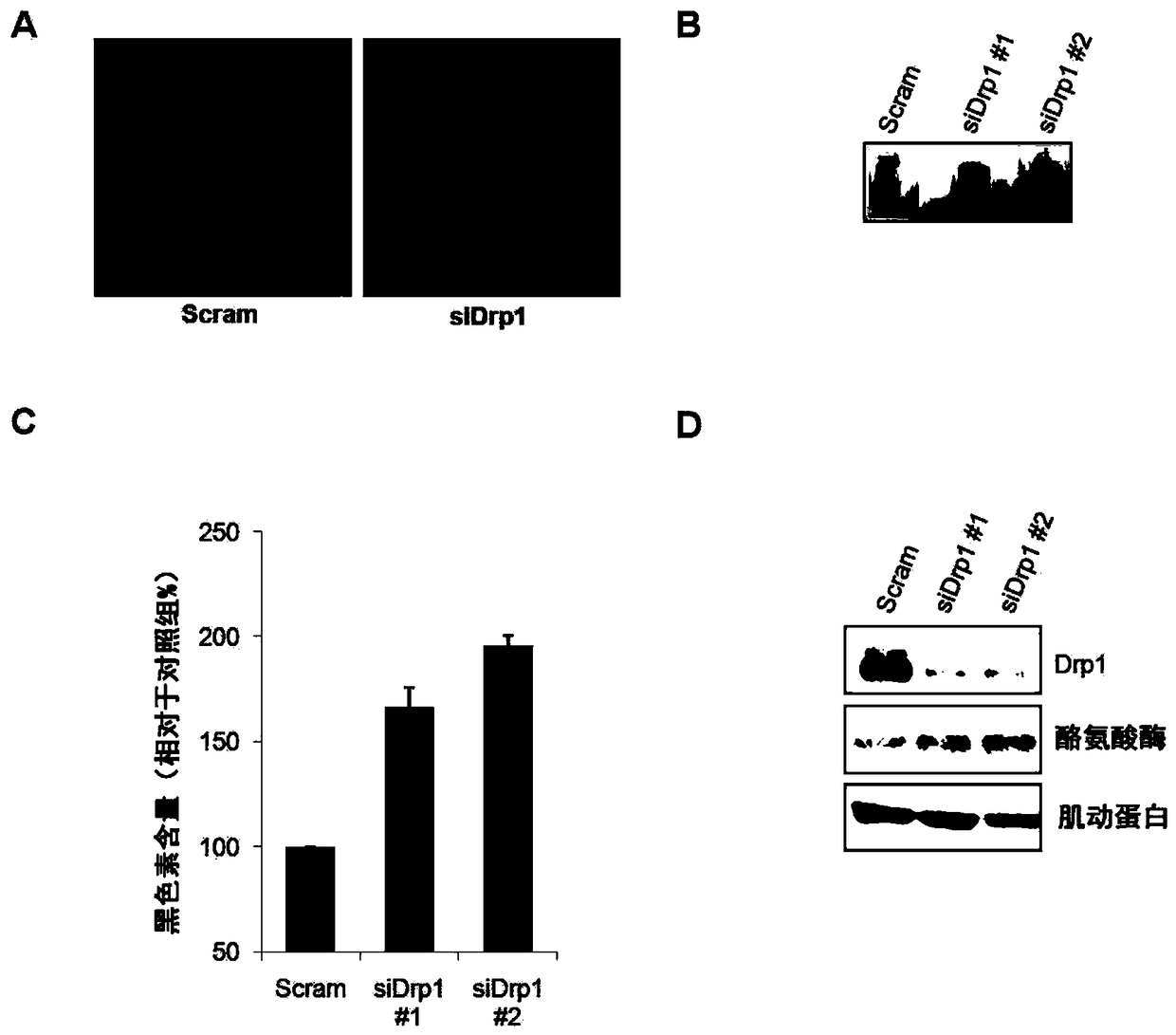 Screening method of whitening substance using mitochondrial dynamics and kit using same