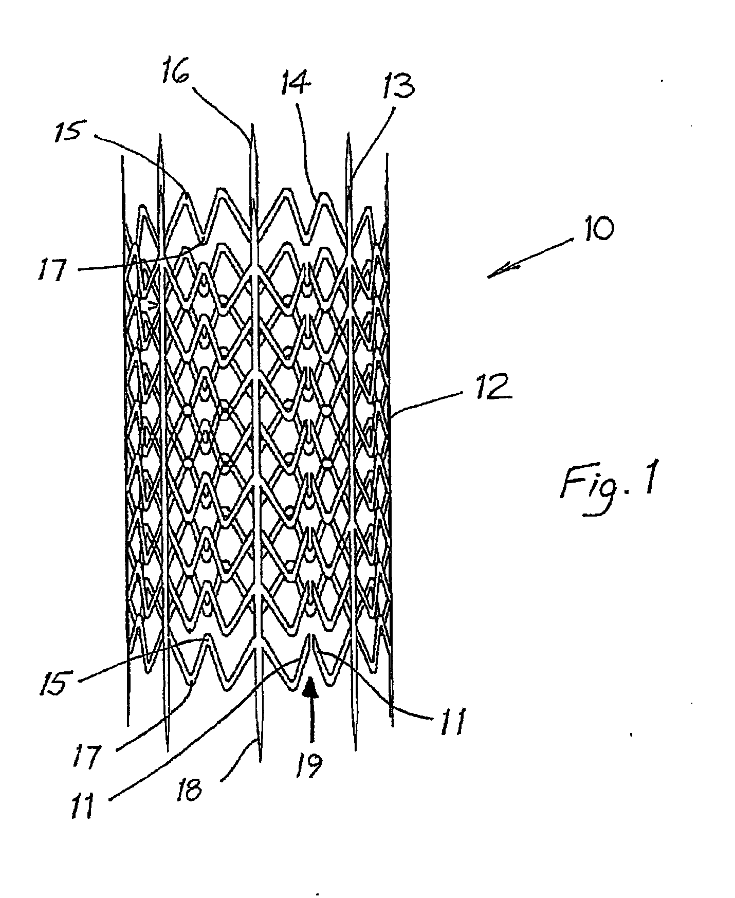 Endovenous valve transfer stent