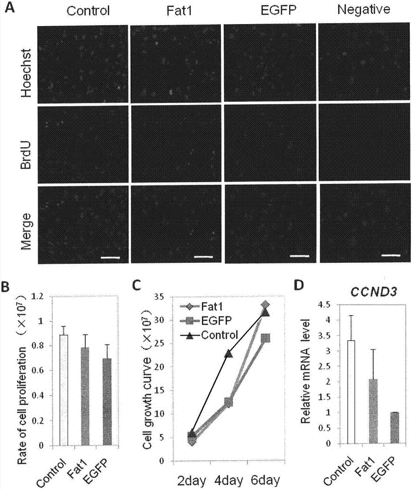 Method for synthesis, transfection and detection of anti-aging gene of goat