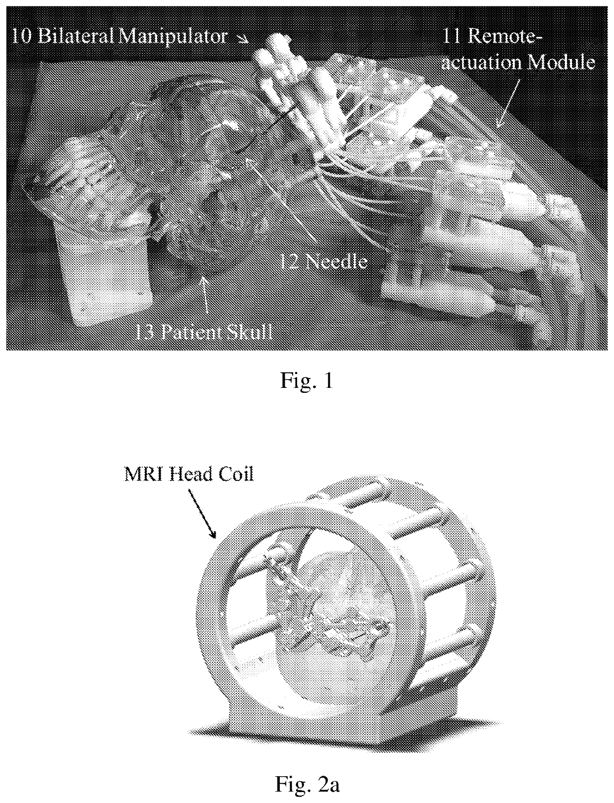 Robotic stereotactic system for mri-guided neurosurgery