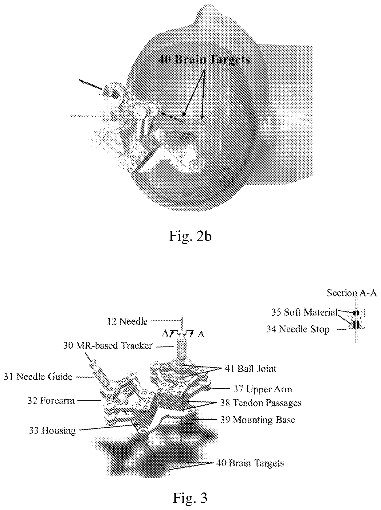 Robotic stereotactic system for mri-guided neurosurgery