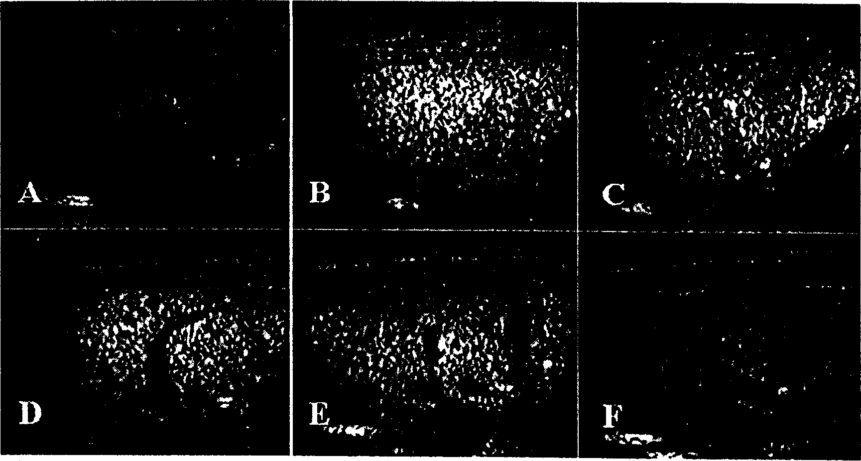 Method of preparing ultrasonic contrast agent using mechanical oscillation