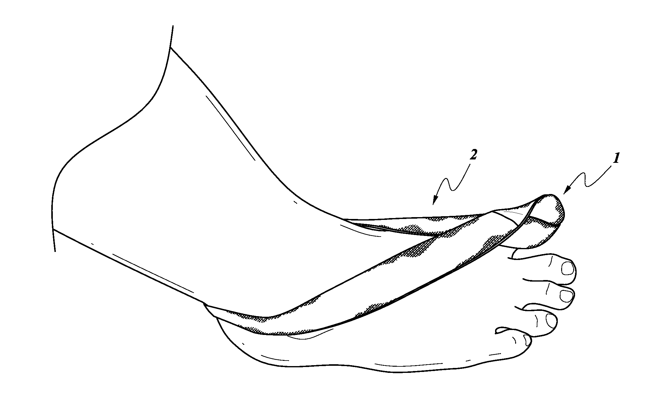 Dynamic hallux tension device for treatment of plantar fasciitis