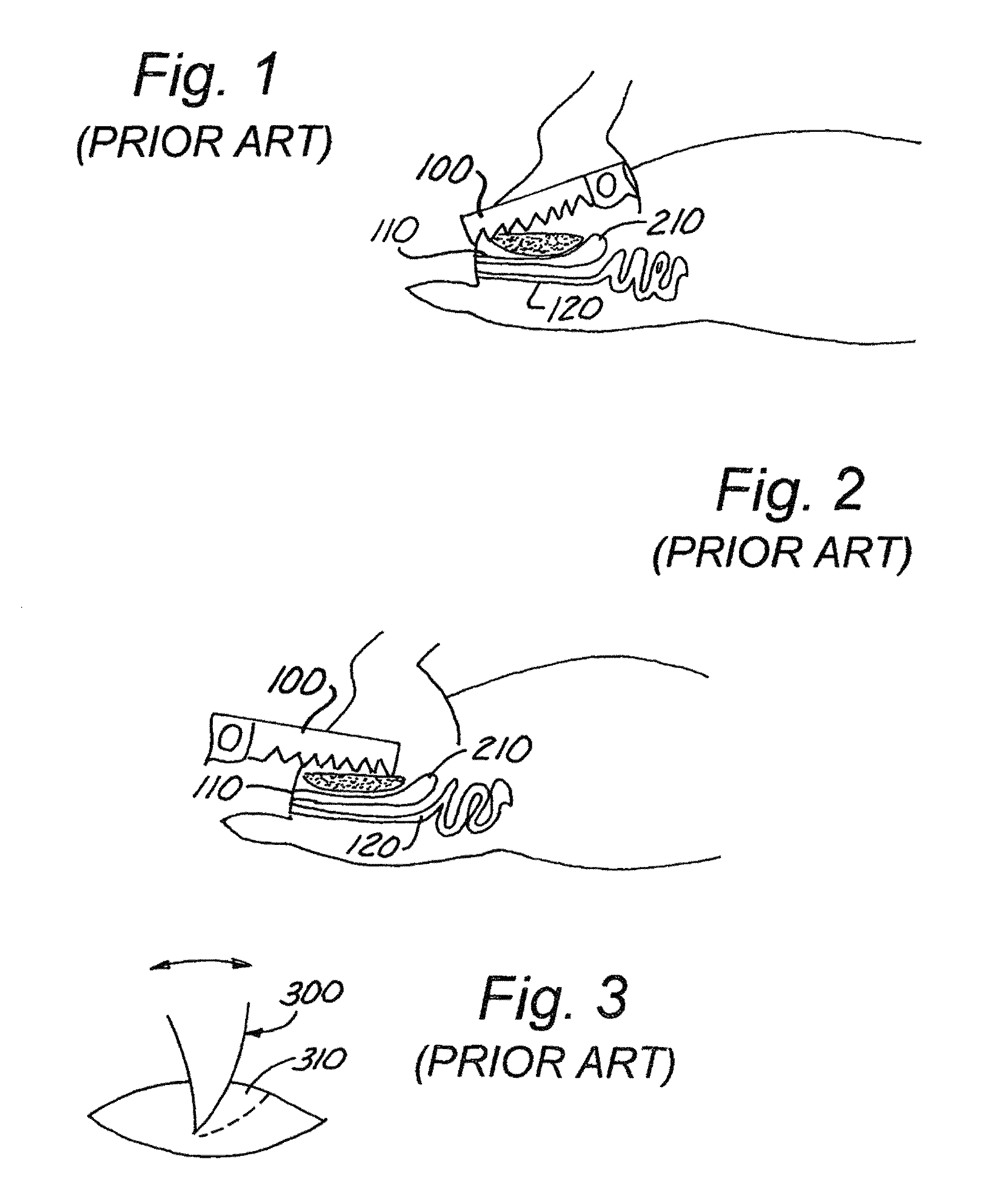 Field dressing knife