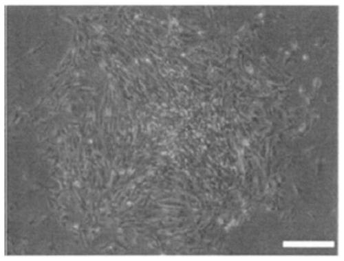 Hair growth liquid containing dermal papilla cell-derived exosome and preparation method thereof