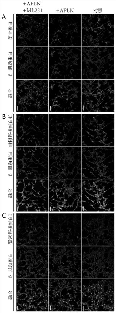 Applin-APJ inhibitor in the application of the application of blood test barrier damage drugs