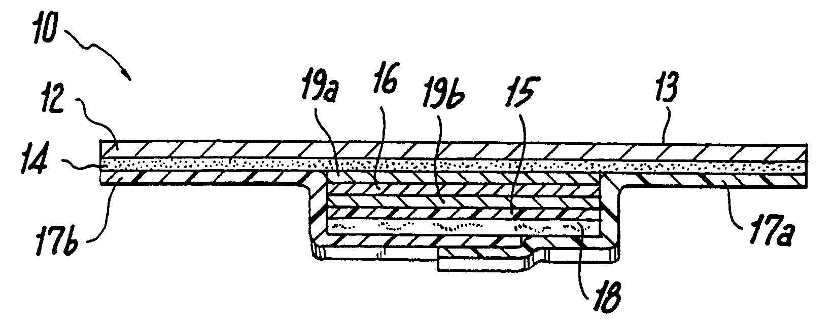 Ultrasound bandages