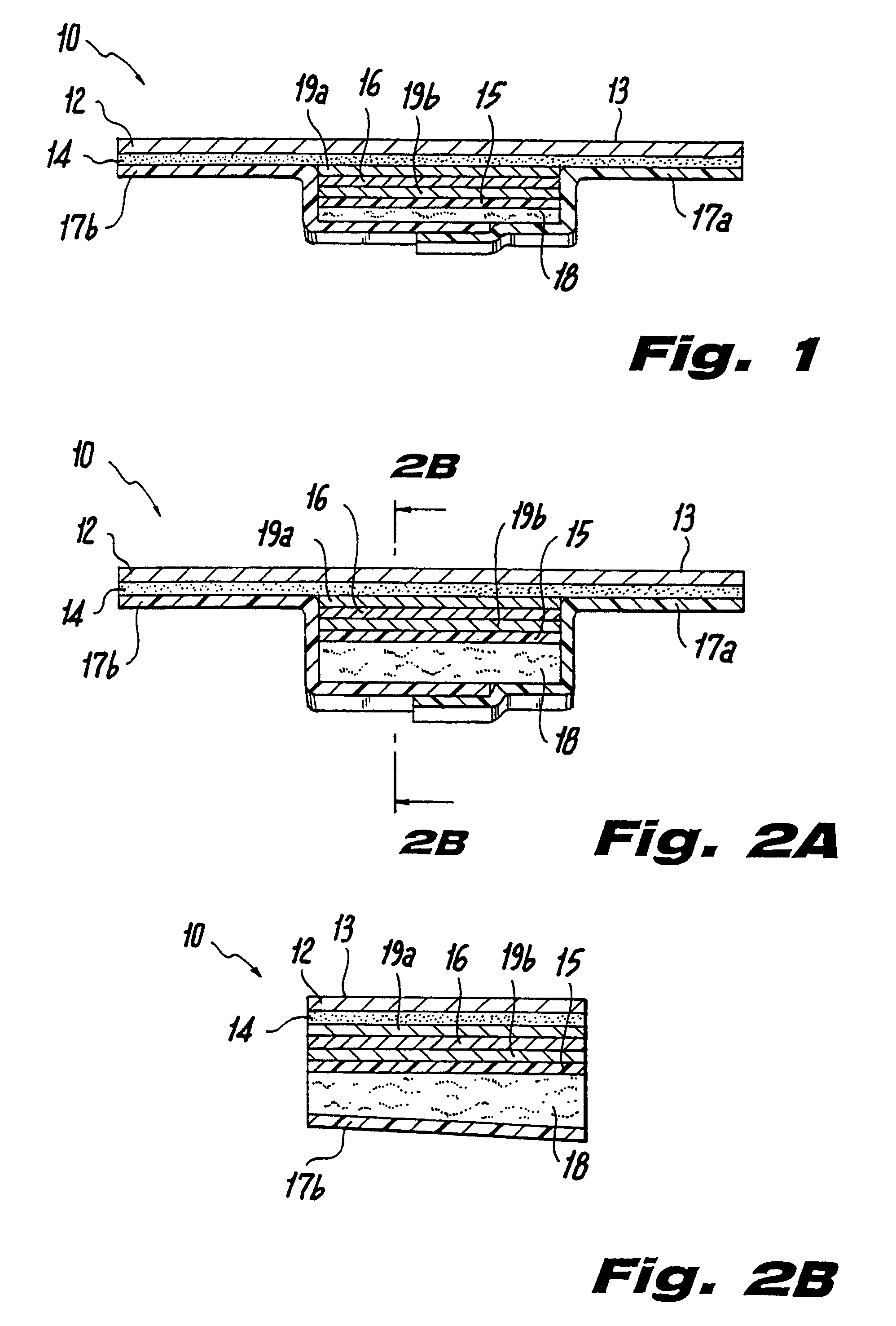 Ultrasound bandages