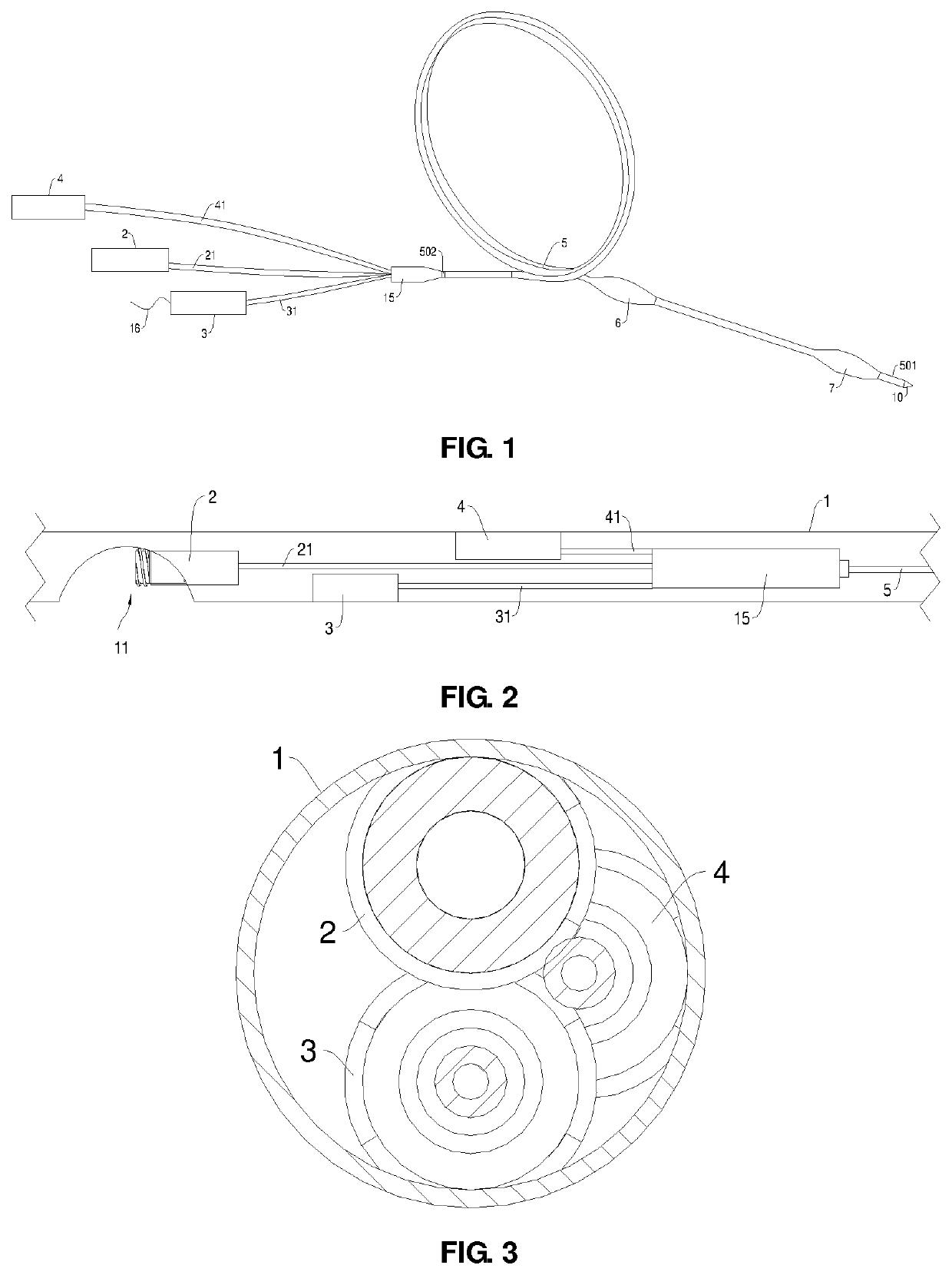 Double-Balloon Catheter Device for Gastrointestinal Anastomosis