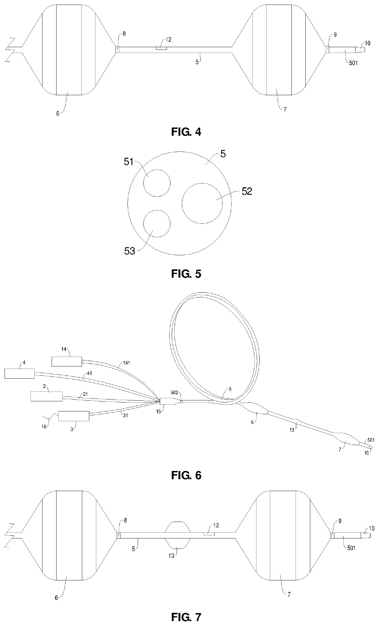 Double-Balloon Catheter Device for Gastrointestinal Anastomosis