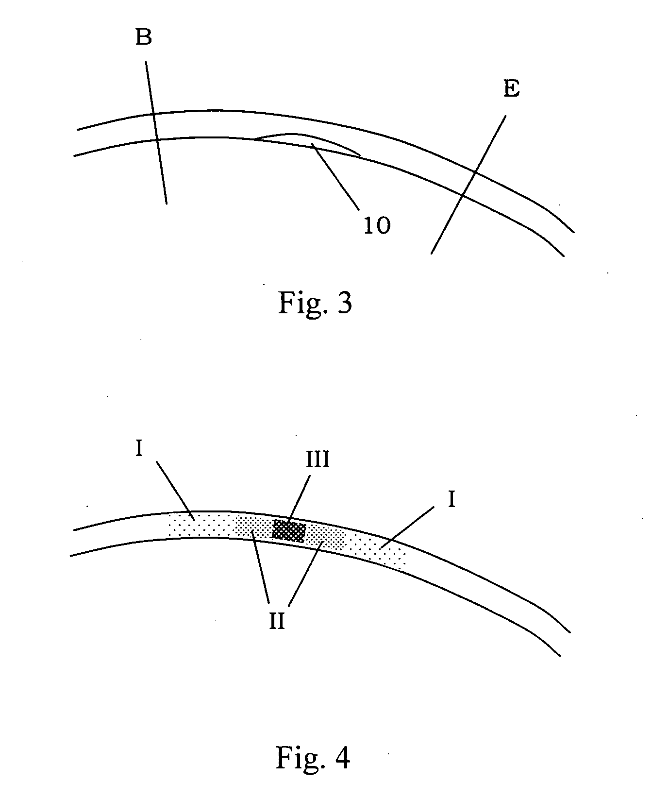 Pressure measurement system