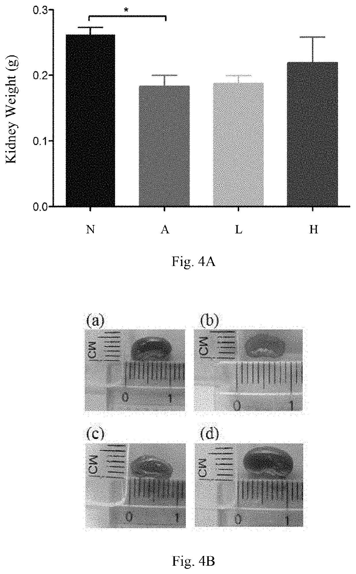 Pharmaceutical composition and food composition with strains of lactic acid bacteria for improving of kidney disease and inhibiting inflammation