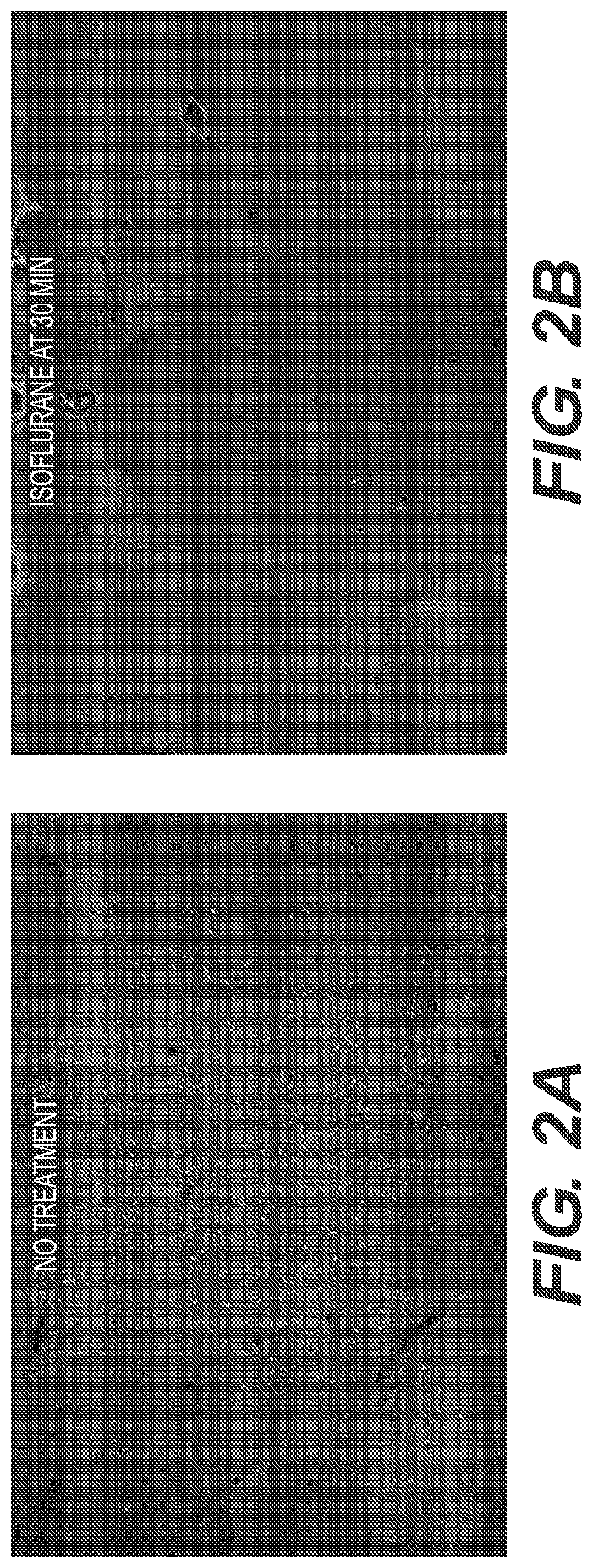 Methods for treating or preventing organophosphate poisoning