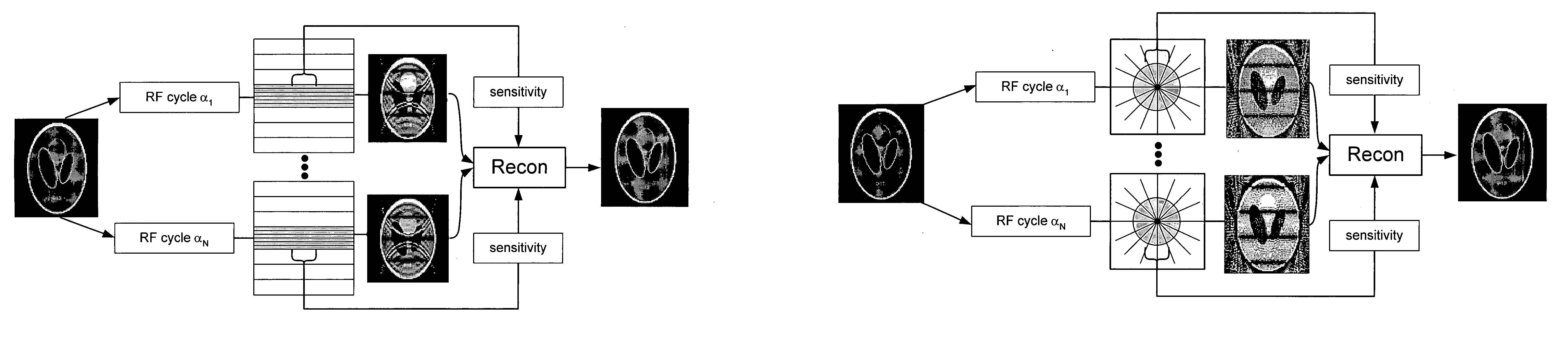 Artifact reduction in ssfp MRI using super field view reconstruction