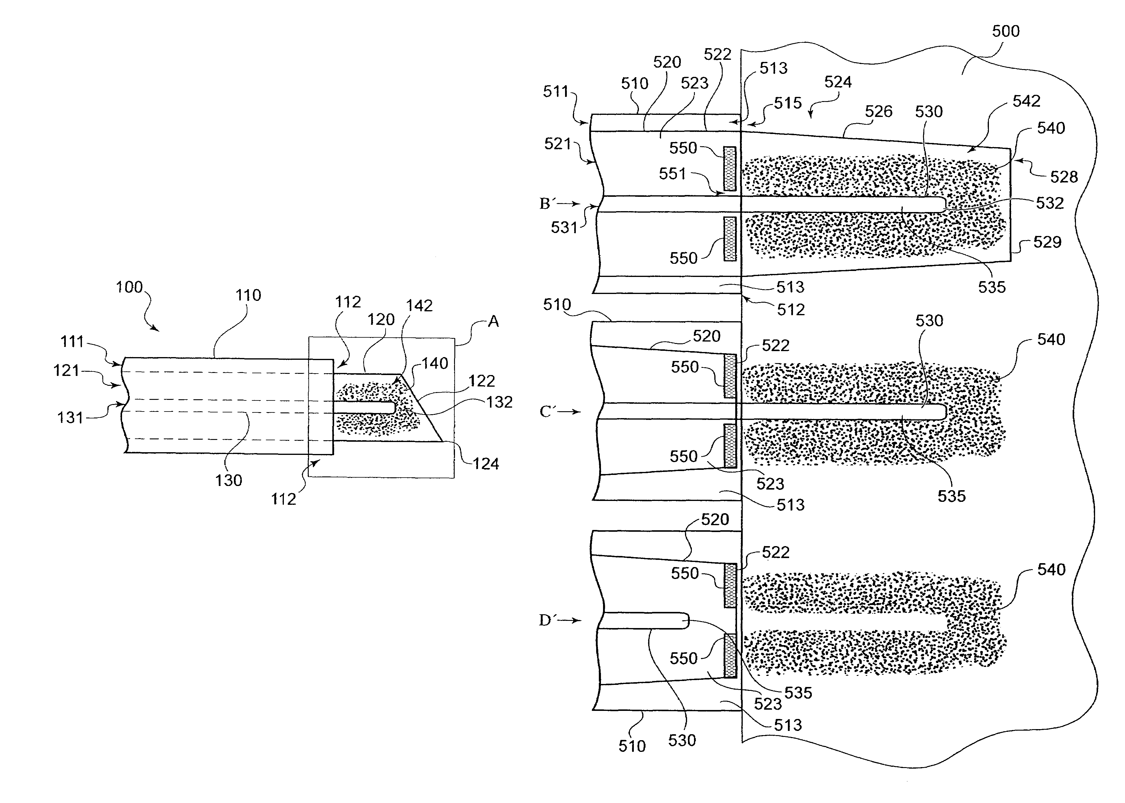 Multiple needle injection catheter