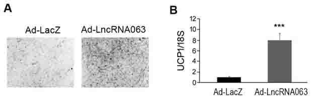 LncRNA-063 and application thereof