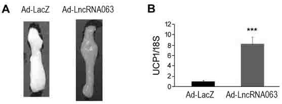 LncRNA-063 and application thereof