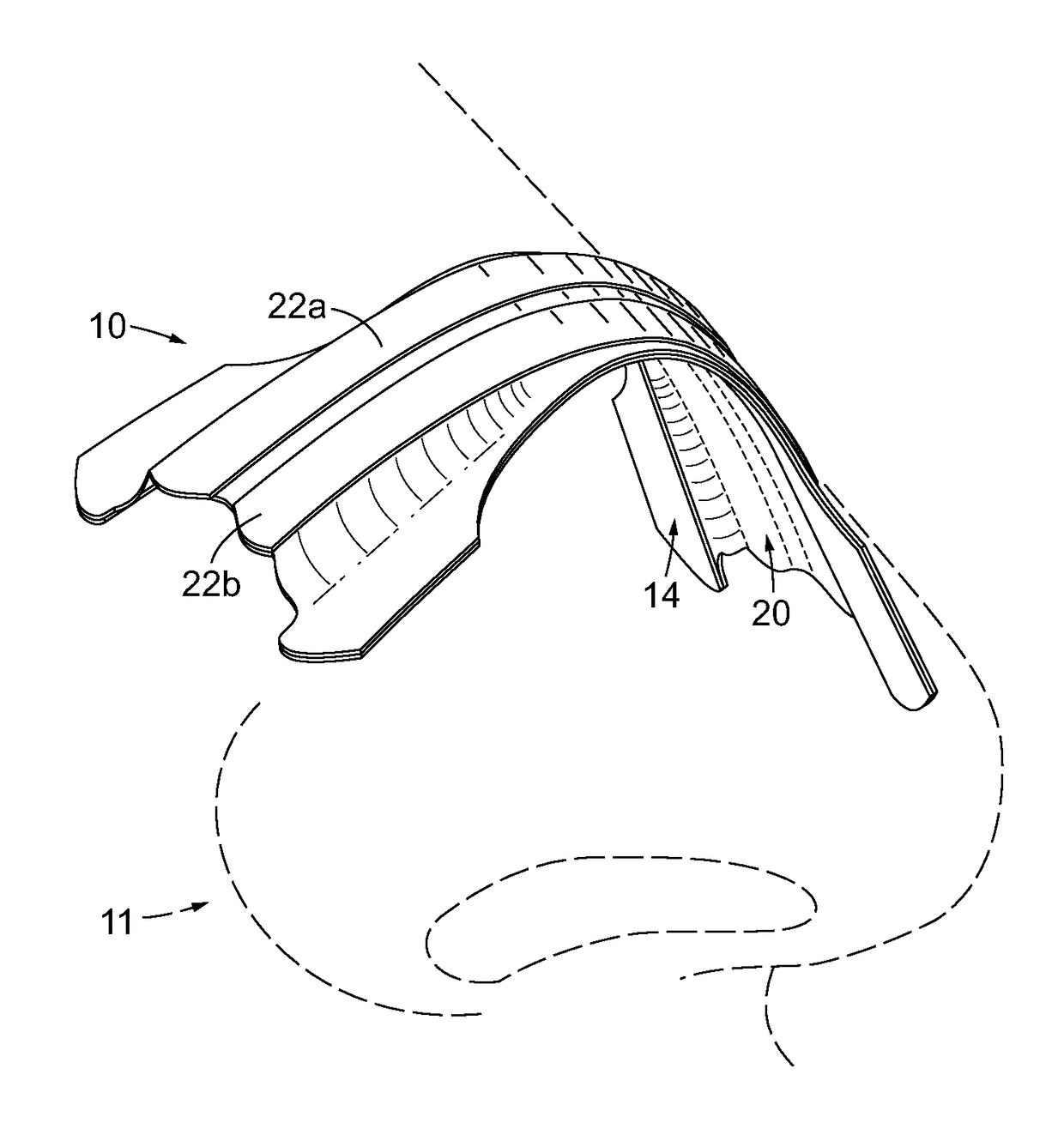 Nasal dilator with elastic membrane structure