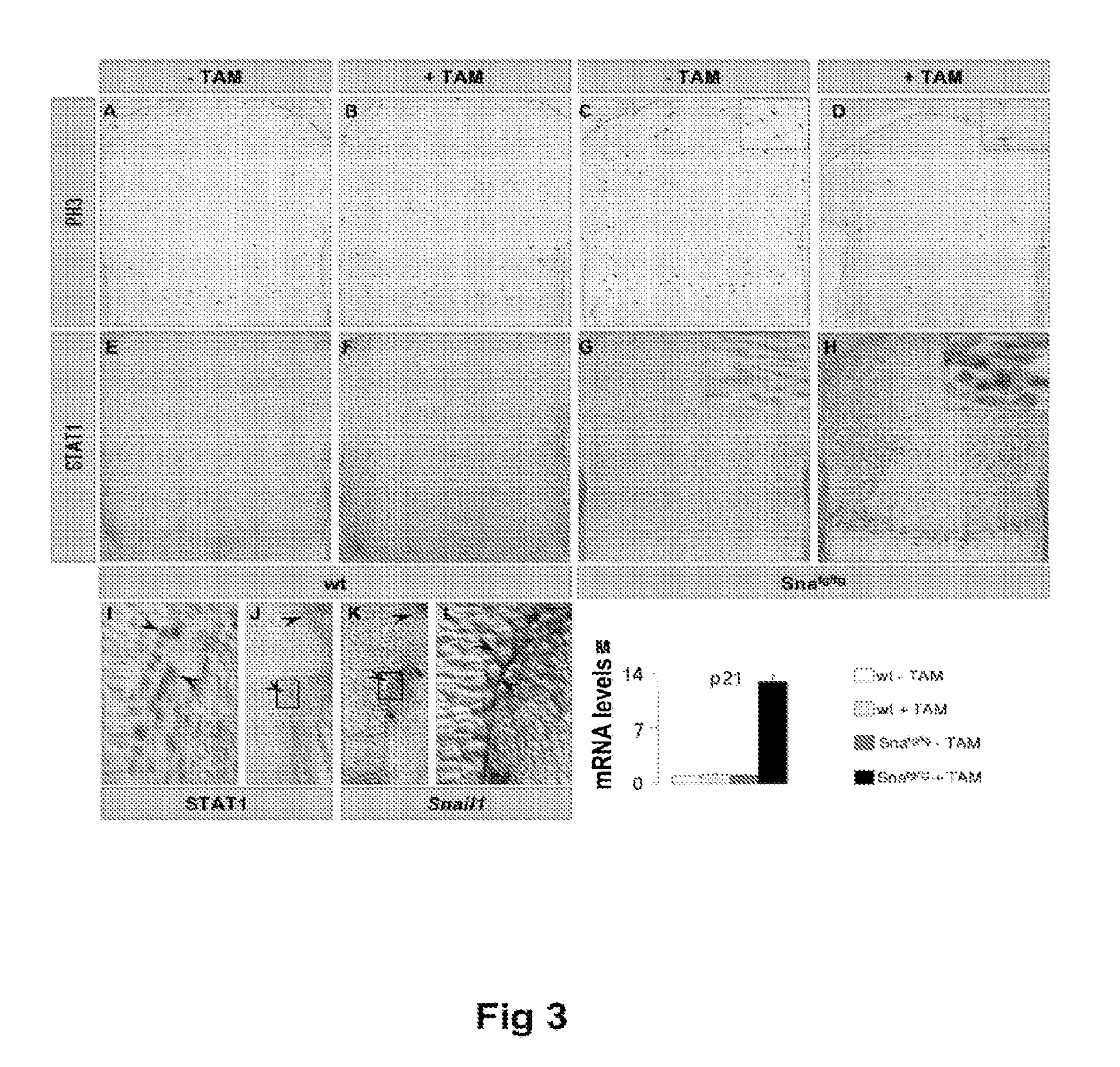 Methods of identifying and using snail1 inhibitory compounds in chondrodysplasia treatment and preparation of pharmaceutical compositions