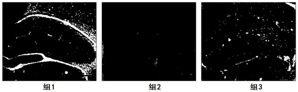 Neural stem cell nose drop as well as preparation method and application thereof