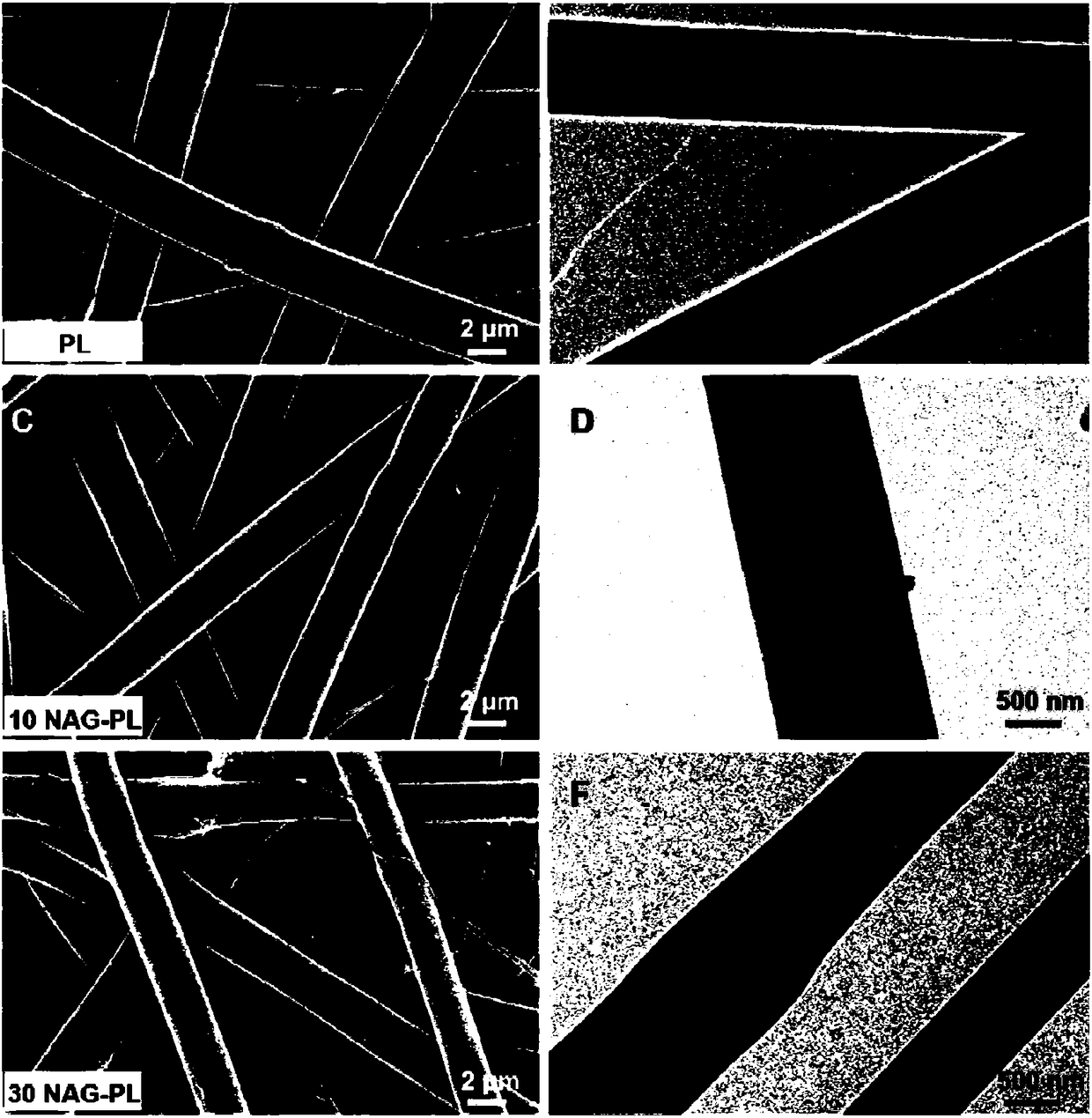 Nanofiber membrane for wound healing and preparation method and application thereof