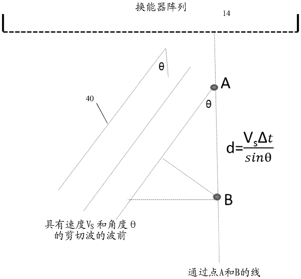 Speed ​​of Sound Imaging Using Shear Waves