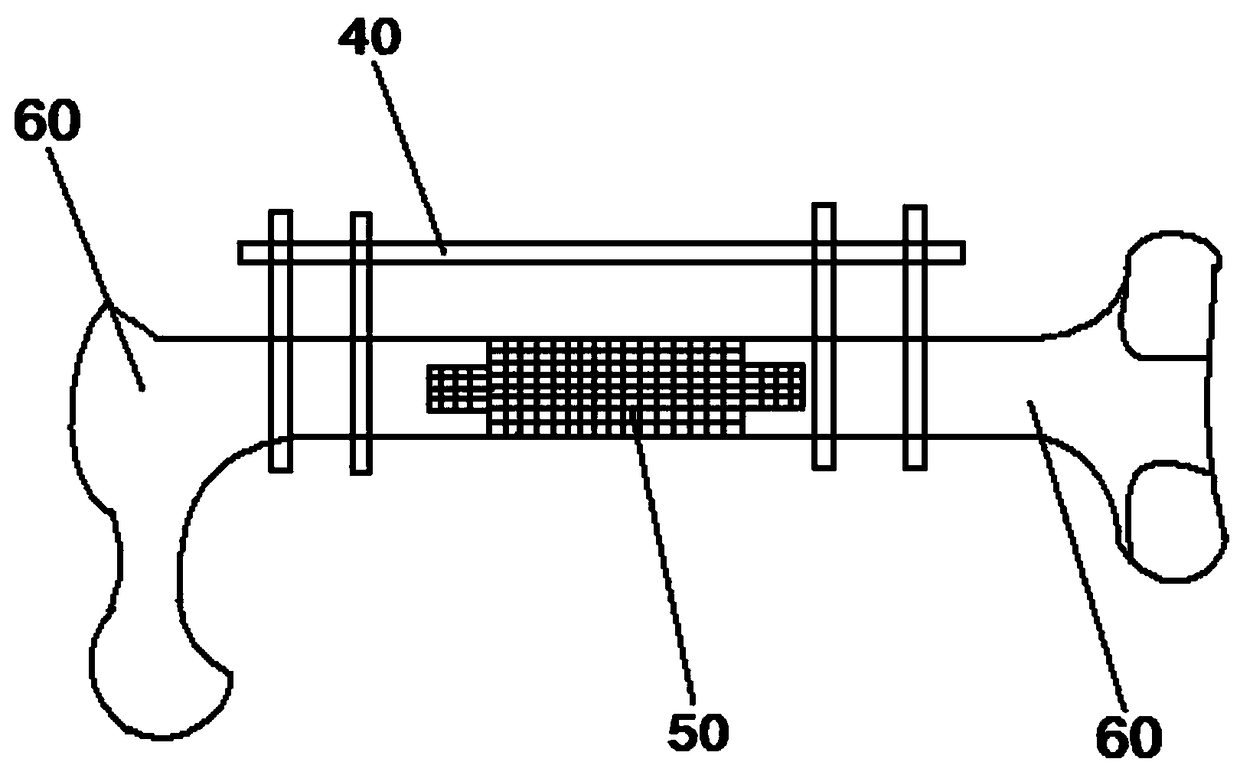 Bone defect filling scaffold structure