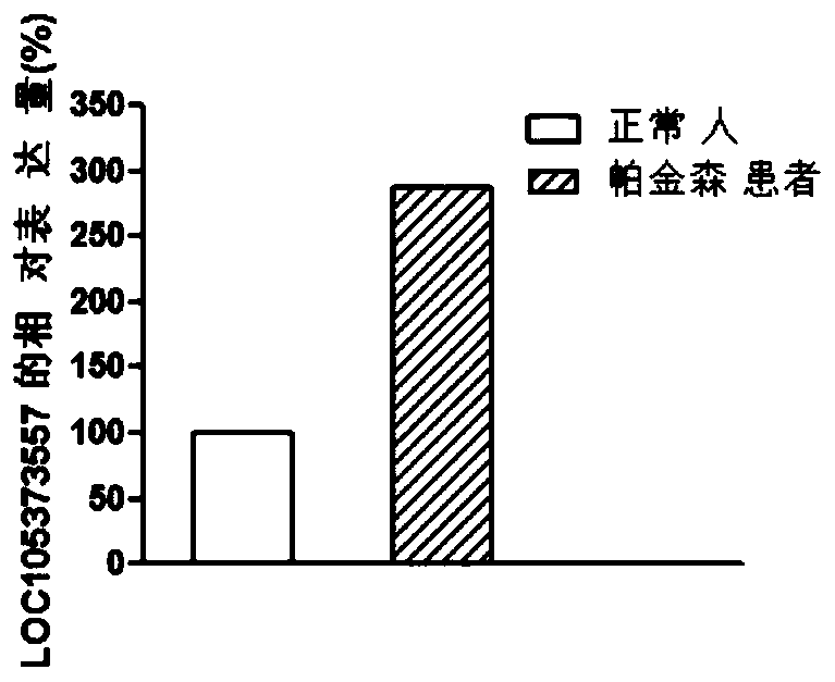 Biomarker related to occurrence and development of Parkinson's disease