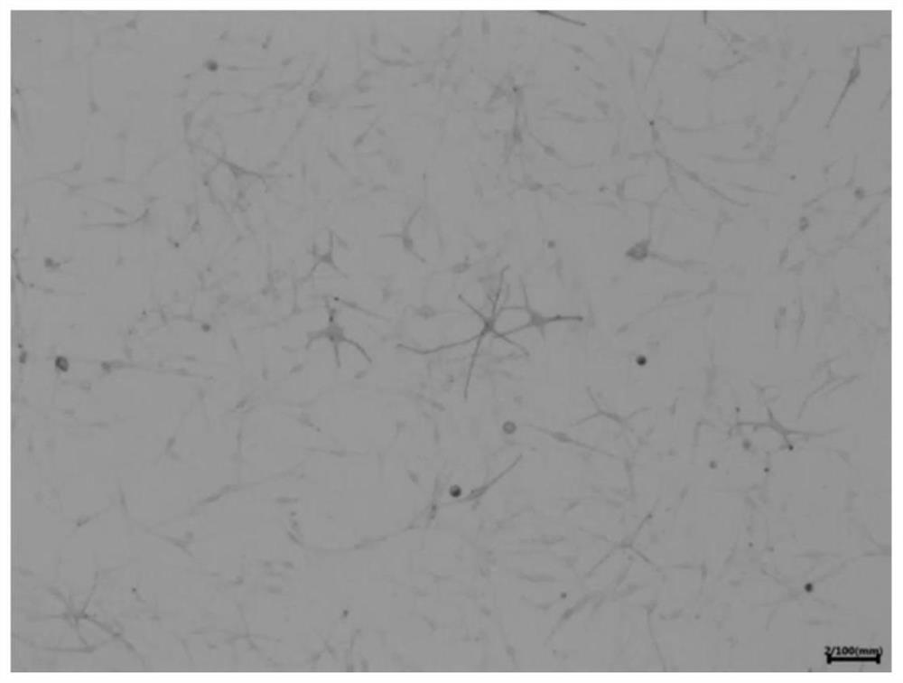 Collagen melanocyte compound as well as preparation method and application thereof