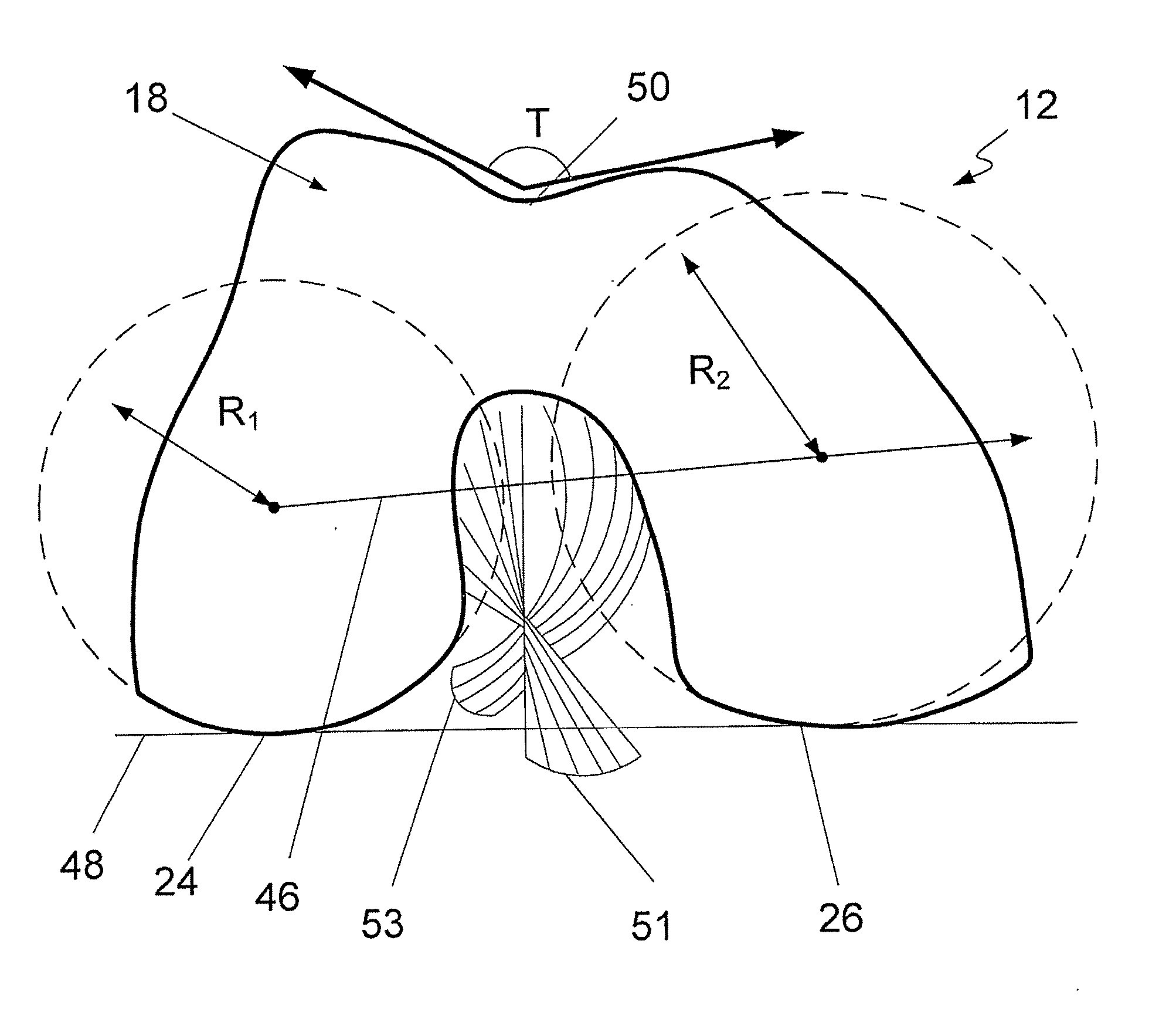 Prosthetic Knee