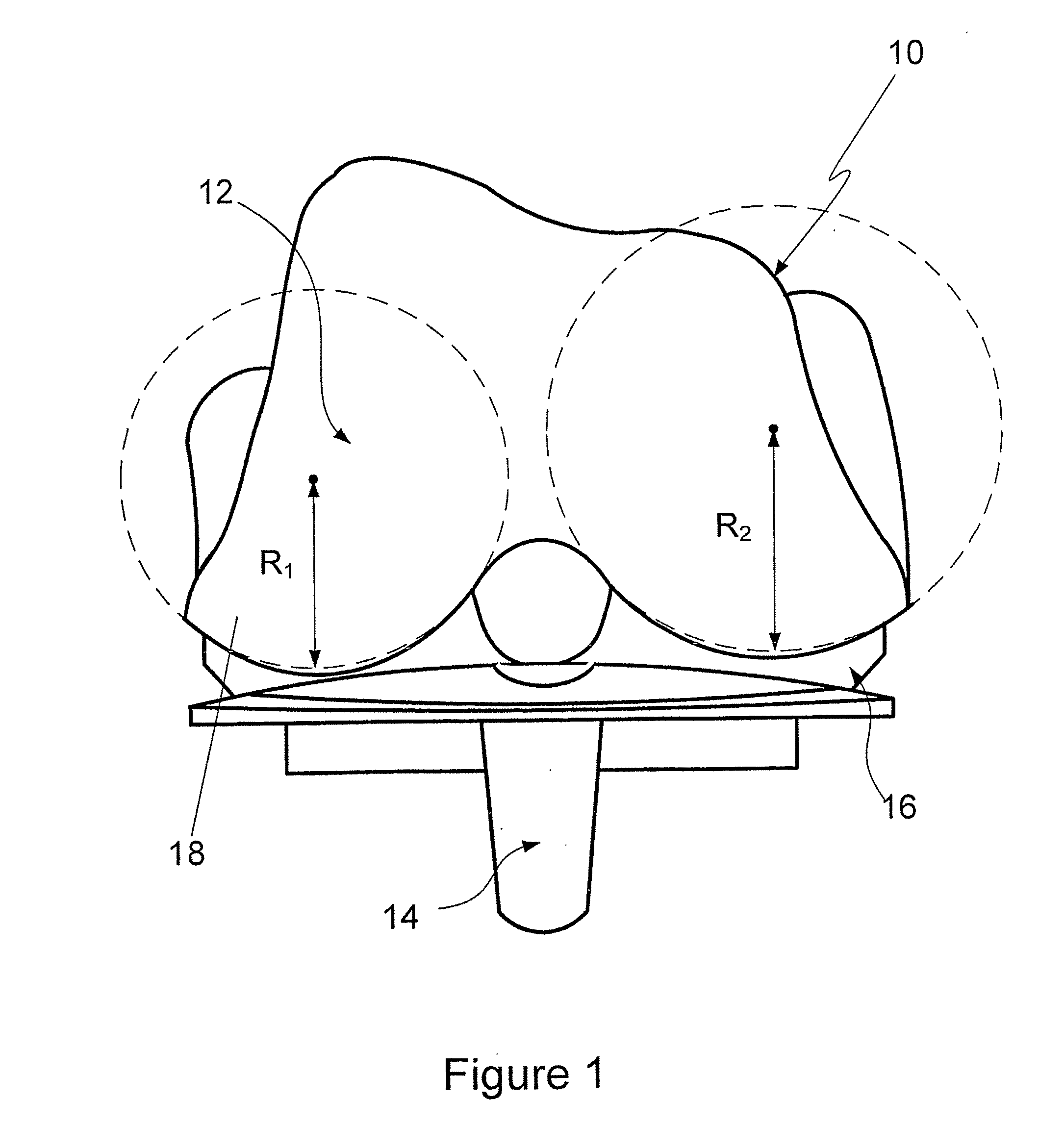 Prosthetic Knee